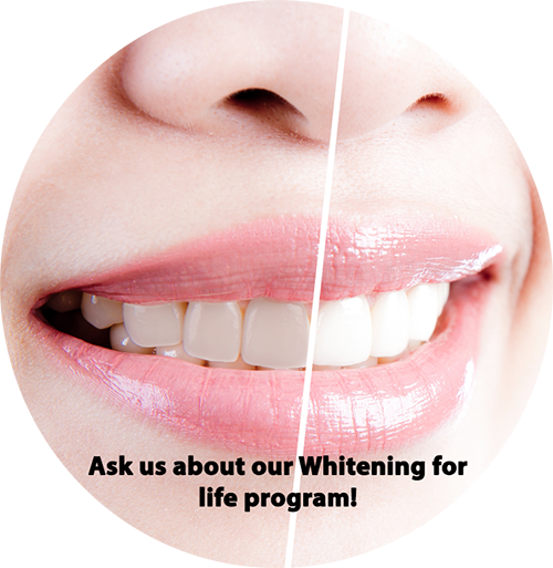 Ask us about our Whitening for Life program!